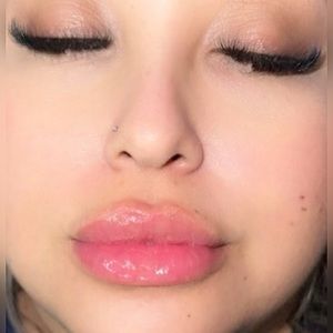 No needle lip filler